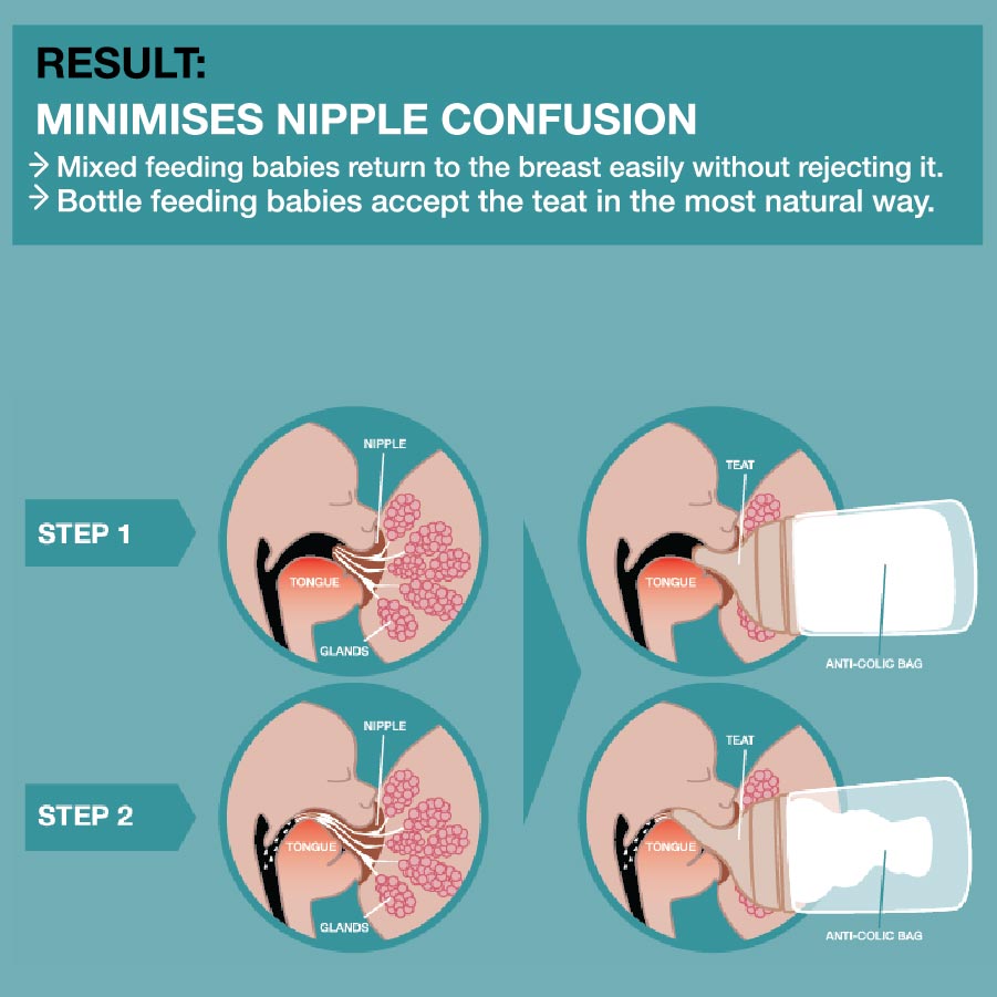 SUAVINEX Zero Zero Anti Colic Bottle 180ml [Slow Flow 0M+] | Baby Feeding